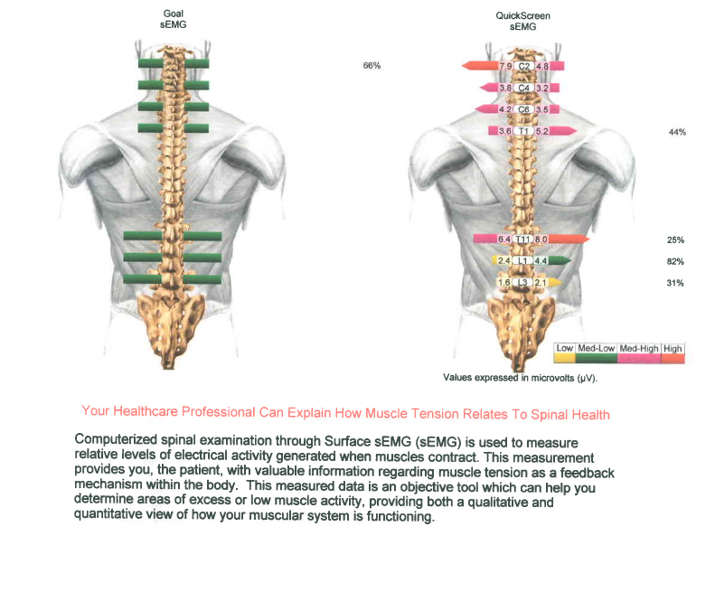 Sample MyoVision ScanVision report comparing a Goal sEMG reading to an actual patient QuickScreen sEMG reading along the spine